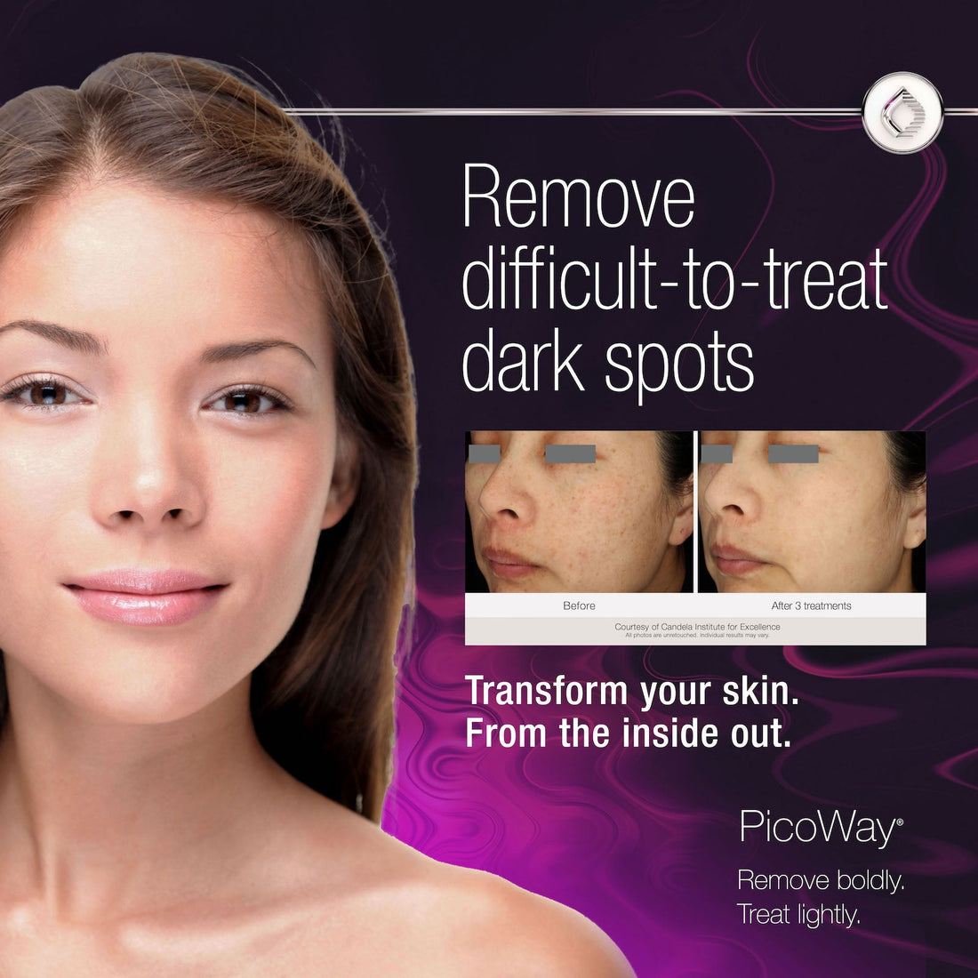 Picoway ® Resolve Laser Rejuvenation in NYC (Packgae of 3, 5, 10) - The DLG Store